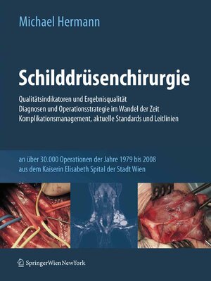 cover image of Schilddrüsenchirurgie--Qualitätsindikatoren und Ergebnisqualität, Diagnosen und Operationsstrategie im Wandel der Zeit, Komplikationsmanagement, aktuelle Standards und Leitlinien